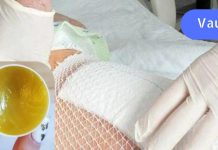 ბებიაჩემს გაუჩნდა ნაწოლები. დედამ კი მის სამკურნალოდ ეს მალამო გამოიყენა..აი როგორ უნდა მოამზადოთ ის..