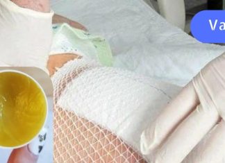 ბებიაჩემს გაუჩნდა ნაწოლები. დედამ კი მის სამკურნალოდ ეს მალამო გამოიყენა..აი როგორ უნდა მოამზადოთ ის..