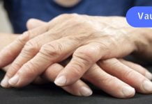 ართრიტის მკურნალობა ხალხური საშუალებებით: ეს უნდა სცადოთ..