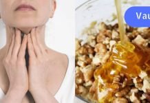 იმისთვის, რომ დააბალანსოთ ფარისებრი ჯირკვალი, უნდა გამოიყენოთ ეს რეცეპტი.