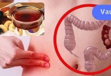 ყაბზობა კლავს თირკმლებს: ბუნებრივი საშუალებები ნაწლავის ფუნქციის გასაუმჯობესებლად