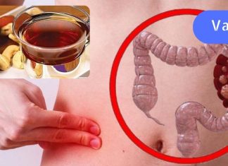 ყაბზობა კლავს თირკმლებს: ბუნებრივი საშუალებები ნაწლავის ფუნქციის გასაუმჯობესებლად