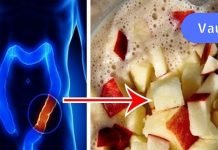 გაასუფთავეთ ნაწლავი ტოქსიკური ნარჩენებისგან ვაშლით, თაფლითა და სელის თესლით..