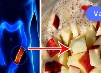 გაასუფთავეთ ნაწლავი ტოქსიკური ნარჩენებისგან ვაშლით, თაფლითა და სელის თესლით..