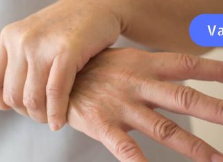 უმკურნალეთ სახსრების ტკივილს უმოკლეს დროში! ძალიან ეფექტურია..