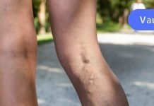 თუ თრომბის სიმპტომები გაქვს, სასწრაფოდ უნდა დაიწყო ამ ფაფის მიღება. ის ხსნის თრომბს..