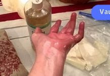 ეს ზეთი სახსარზე წავისვი და დილით გამეღვიძა ყოველგვარი ტკივილის გარეშე – ის ნამდვილად მუშაობს