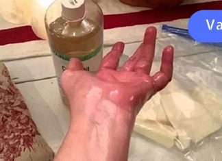 ეს ზეთი სახსარზე წავისვი და დილით გამეღვიძა ყოველგვარი ტკივილის გარეშე – ის ნამდვილად მუშაობს