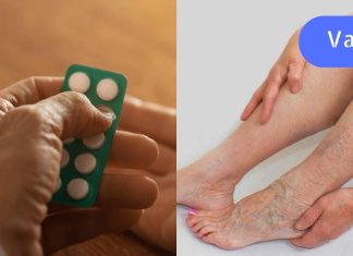 ასპირინის თერაპიული ხსნარი ვარიკოზული ვენებისა და ოსტეოქონდროზის დროს