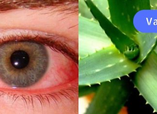 დიდი ხნის მანძილზე მტანჯავდა გლაუკომა. ბოლოს სახლში ვიპოვე ხალხური მედიცინის წიგნი და მასში აღმოვაჩინე სამკურნალო რეცეპტები. ერთხელ და სამუდამოდ განვთავისუფლდი ამ მტანჯველი პრობლემისგან..