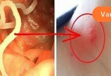 როგორ მოვიშოროთ პარაზიტები: ყველაზე ეფექტური საშუალებები ორგანიზმიდან ჭიების მოსაშორებლად..