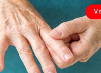 იჩქარე! და დაძლიეთ ართრიტის ტკივილი, ამ საშუალების მიღებით დღეს.