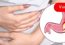 კუჭის წყლულის სიმპტომები და მარტივი მკურნალობის ვარიანტები! ამის ცოდნა მნიშვნელოვანია!