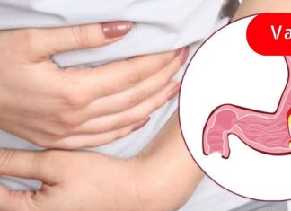 კუჭის წყლულის სიმპტომები და მარტივი მკურნალობის ვარიანტები! ამის ცოდნა მნიშვნელოვანია!