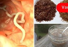 როგორ გავიგოთ, გვაქვს თუ არა ნაწლავის ჭიები? ამის ცოდნაში ეს სტატია დაგეხმარებათ!