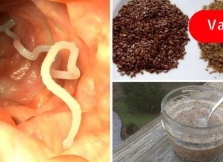 როგორ გავიგოთ, გვაქვს თუ არა ნაწლავის ჭიები? ამის ცოდნაში ეს სტატია დაგეხმარებათ!