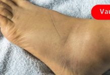 მეცნიერები განმარტავენ 6 ფაქტორს, რაც იწვევს ფეხების შეშუპებას! Შენ უნდა იცოდე!