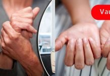 რკინის ქრონიკული დეფიციტის 5 ნიშანი. ქალების უმეტესობა ამას უგულებელყოფს