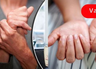 რკინის ქრონიკული დეფიციტის 5 ნიშანი. ქალების უმეტესობა ამას უგულებელყოფს