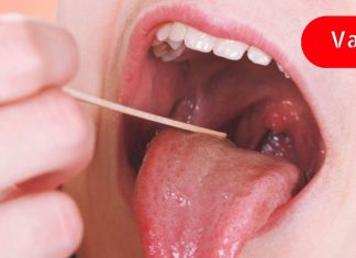 როგორ მოვიშოროთ შეშუპებული ყელი ერთ დღეში ყოველგვარი მედიკამენტების გარეშე? ეს მნიშვნელოვანია!