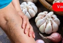 ბუნებრივი სისხლის გამათხელებლები, რომლებიც ხელს უშლიან სისხლის შედედებას