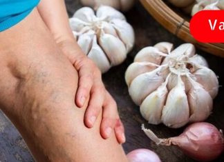 ბუნებრივი სისხლის გამათხელებლები, რომლებიც ხელს უშლიან სისხლის შედედებას