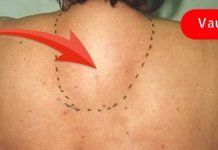 ორანიზმიდან მარილების გამოსადევნად ეს რეცეპტი უნდა გამოიყენოთ! ეფექტურია!