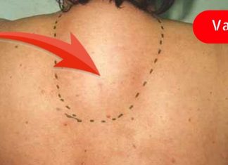 ორანიზმიდან მარილების გამოსადევნად ეს რეცეპტი უნდა გამოიყენოთ! ეფექტურია!