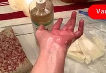 ეს ზეთი სახსარზე წავისვი და დილით გამეღვიძა ყოველგვარი ტკივილის გარეშე – ის ნამდვილად მუშაობს