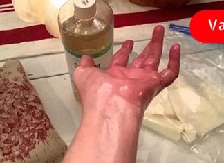 ეს ზეთი სახსარზე წავისვი და დილით გამეღვიძა ყოველგვარი ტკივილის გარეშე – ის ნამდვილად მუშაობს