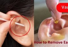 არასოდეს გამოიყენო ყურის ჩხირი ცვილის მოსაშორებლად.. ის გაგიუარესებს სმენას..