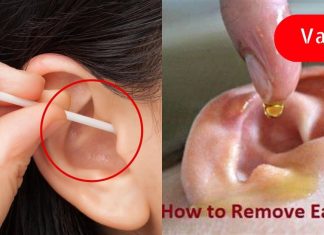 არასოდეს გამოიყენო ყურის ჩხირი ცვილის მოსაშორებლად.. ის გაგიუარესებს სმენას..