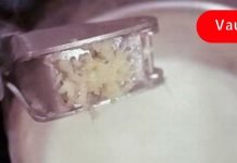 გამოიყენეთ ნივრის რძე საჯდომის ნერვის სამკურნალოდ! უებარია!