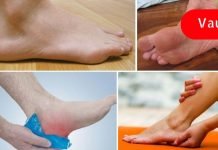 როგორ გავთავისუფლდეთ ქუსლის ტკივილისგან ბუნებრივად? ბუნება ყოველთვის მზადაა დასახმარებლად!