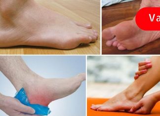 როგორ გავთავისუფლდეთ ქუსლის ტკივილისგან ბუნებრივად? ბუნება ყოველთვის მზადაა დასახმარებლად!