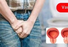 შარდის შეუკავებლობის დროს გამოიყენეთ ეს საშუალებები! ეს მნიშვნელოვანია!