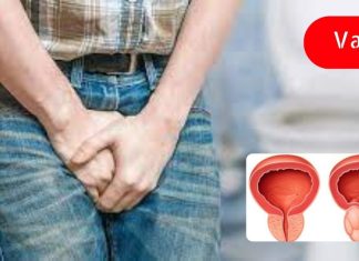 შარდის შეუკავებლობის დროს გამოიყენეთ ეს საშუალებები! ეს მნიშვნელოვანია!