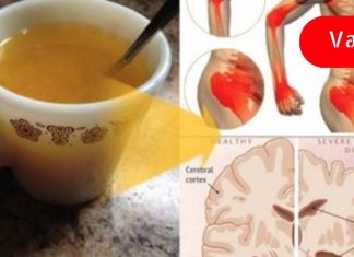 თუ ყოველ დილით დალევთ კურკუმიან წყალს, თქვენი ძვლების ჯანმრთელობა მნიშვნელოვნად გაუმჯობესდება!