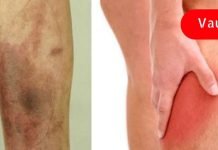 ფეხის ჯანმრთელობის 9 პრობლემა, რომელიც შეიძლება მიუთითებდეს სერიოზულ დაავადებაზე! აუცილებლად წაიკითხეთ!