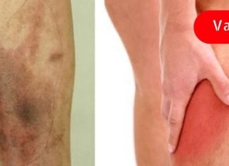 ფეხის ჯანმრთელობის 9 პრობლემა, რომელიც შეიძლება მიუთითებდეს სერიოზულ დაავადებაზე! აუცილებლად წაიკითხეთ!