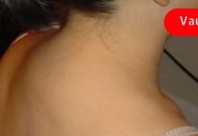 გამოიყენეთ ეს რეცეპტი მარილების სამკურნალოდ. ძალიან ეფექტურია!