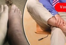 ყურადღება მიაქციე ამ ნიშნებს! ისინი მიუთითებს გულის ცუდ მუშაობაზე! ეს ძალიან მნიშვნელოვანია!