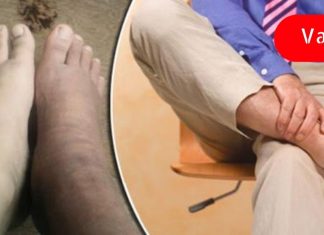 ყურადღება მიაქციე ამ ნიშნებს! ისინი მიუთითებს გულის ცუდ მუშაობაზე! ეს ძალიან მნიშვნელოვანია!