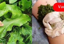 აი როგორ უნდა ამოიღოთ მარილის დეპოზიტები სხეულიდან პირშუშხას ფოთლებით! ეს ინფორმაცია ბევრს გამოადგება!