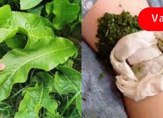 აი როგორ უნდა ამოიღოთ მარილის დეპოზიტები სხეულიდან პირშუშხას ფოთლებით! ეს ინფორმაცია ბევრს გამოადგება!