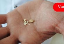 ამ ბუნებრივი საშუალების გამოყენებით, თქვენ ადვილად შეძლებთ თირკმლებიდან კენჭების გამოდევნას!