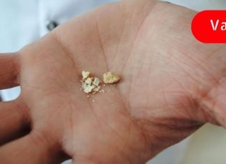 ამ ბუნებრივი საშუალების გამოყენებით, თქვენ ადვილად შეძლებთ თირკმლებიდან კენჭების გამოდევნას!