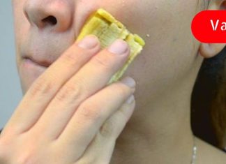 ბანანის ქექი თუ ასეთი სასარგებლო იყორას წარმოვიდგენდი! აი რა შეუძლია მას!