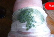 ის ყოველ ღამით მუხლზე კომბოსტოს ფოთლებს იდებდა- ერთი თვის შემდეგ ტკივილი მთლიანად გაქრა