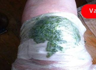 ის ყოველ ღამით მუხლზე კომბოსტოს ფოთლებს იდებდა- ერთი თვის შემდეგ ტკივილი მთლიანად გაქრა